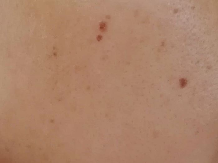 BBクリームを使う前の肌の写真